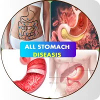 Stomach Diseases & Treatment